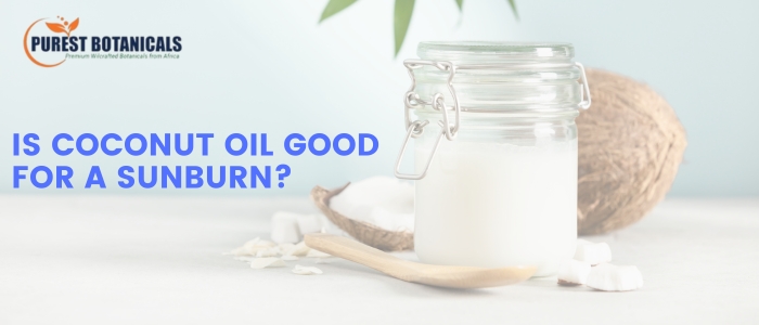 Is Coconut Oil Good For A Sunburn?